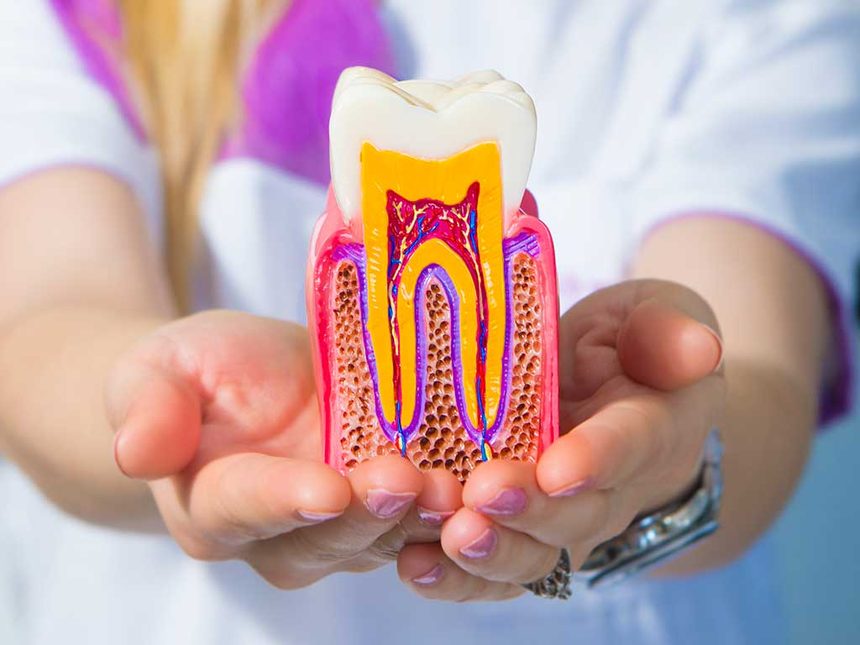 Modelo de dente em corte mostrando o canal